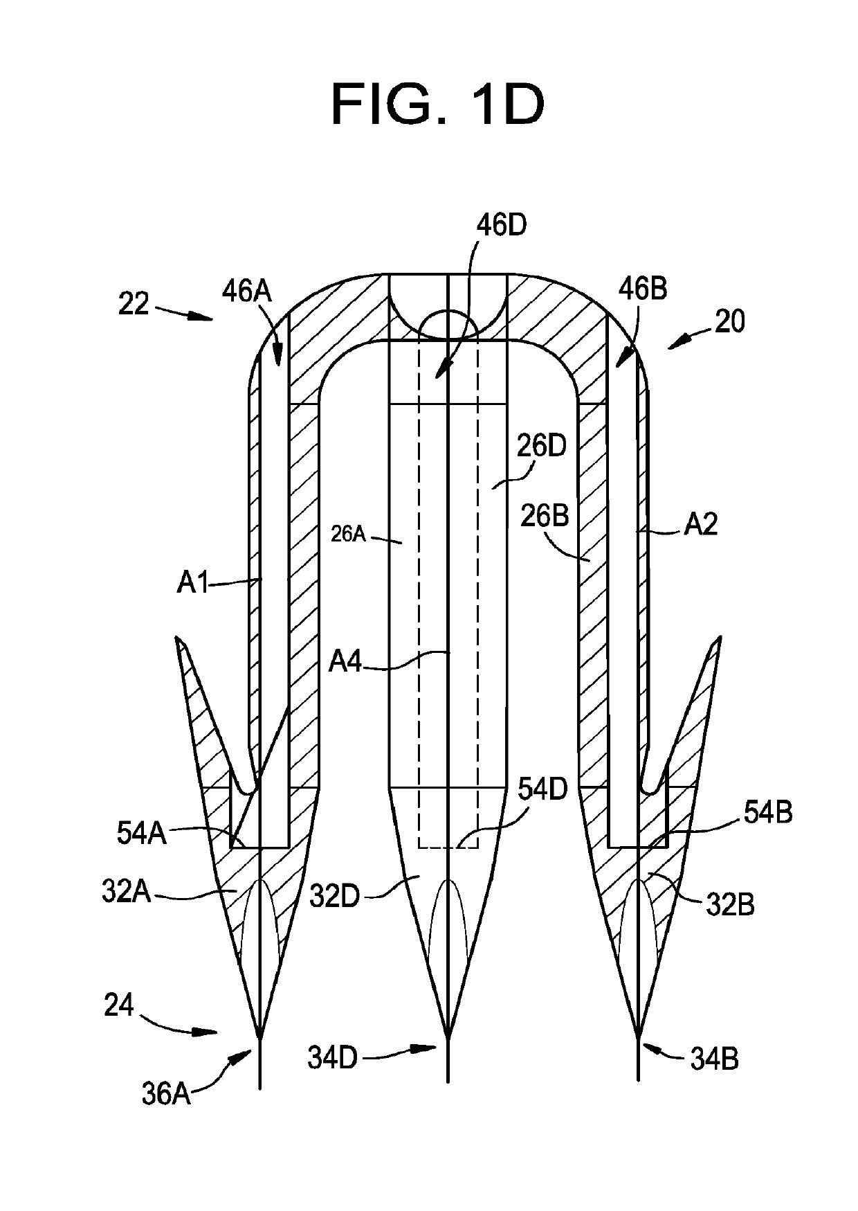 Absorbable surgical fasteners for securing prosthetic devices to tissue