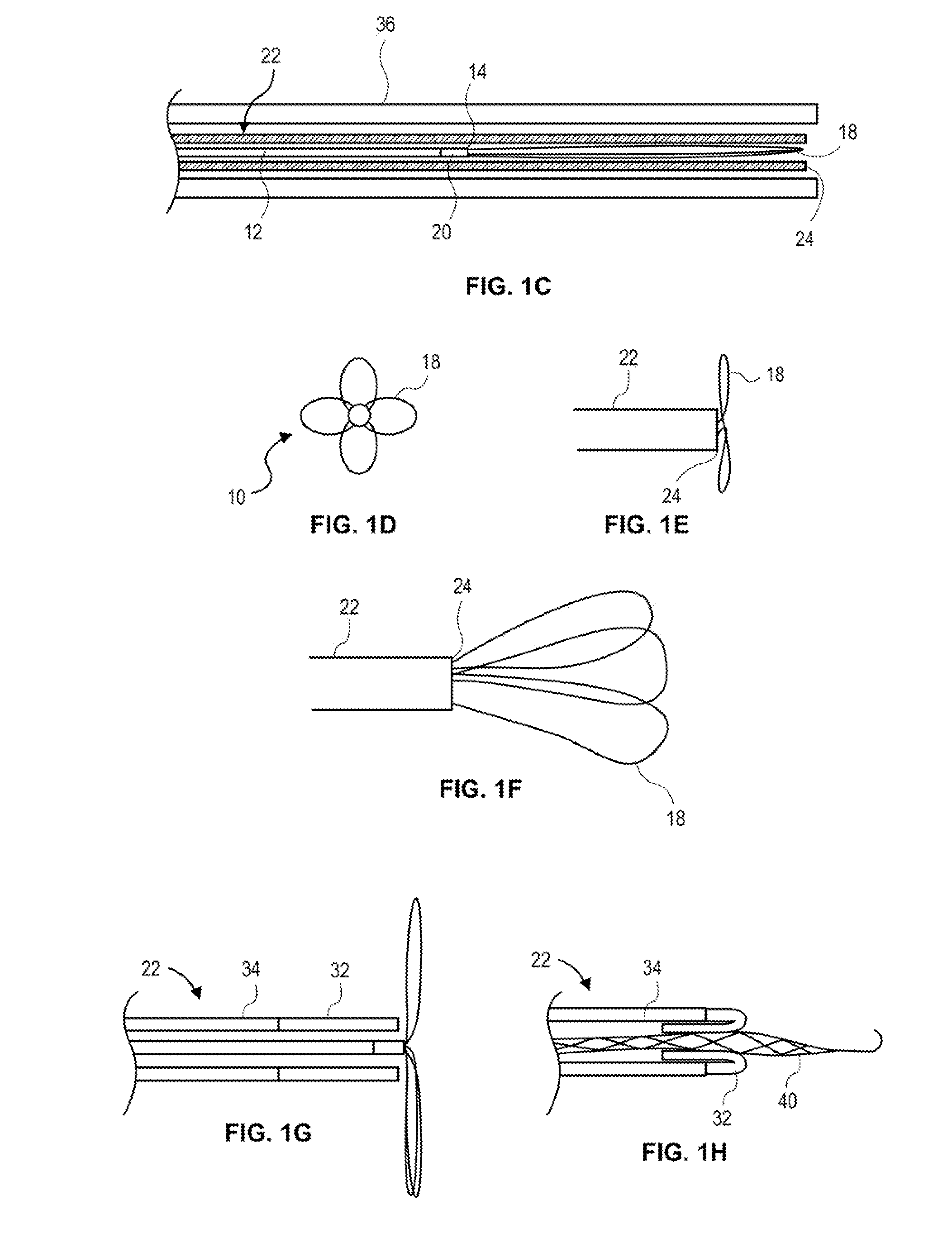 Retrieval snare device and method