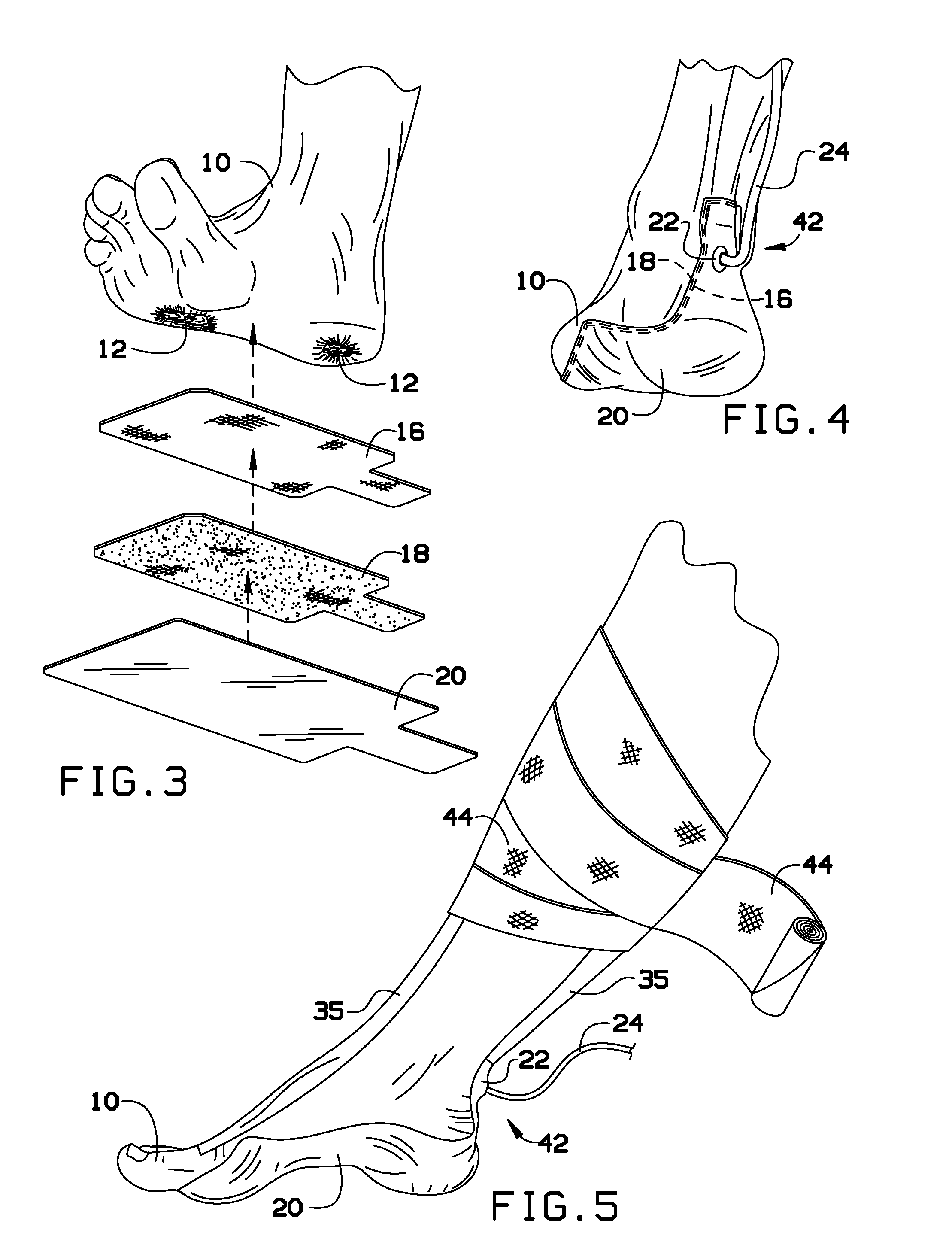 Vacuum cast ("vac-cast") and methods for treatment of plantar wounds