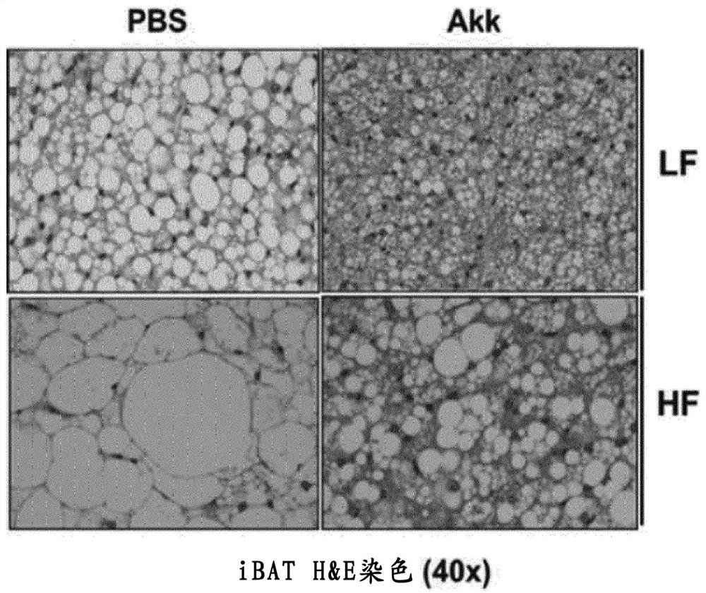 Akkermansia muciniphila strain and use thereof