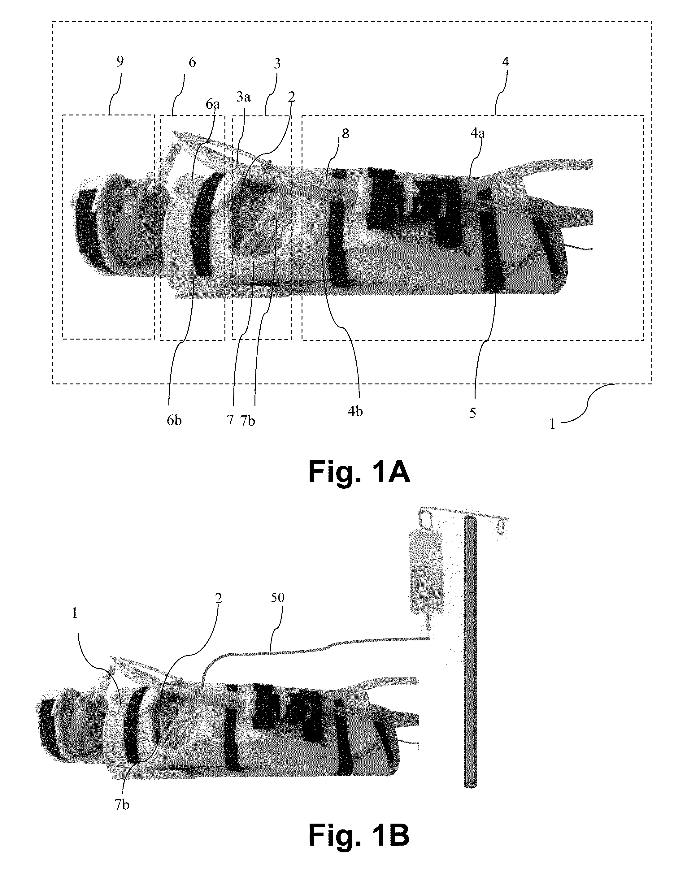 Neonate's immobilizing restrainer