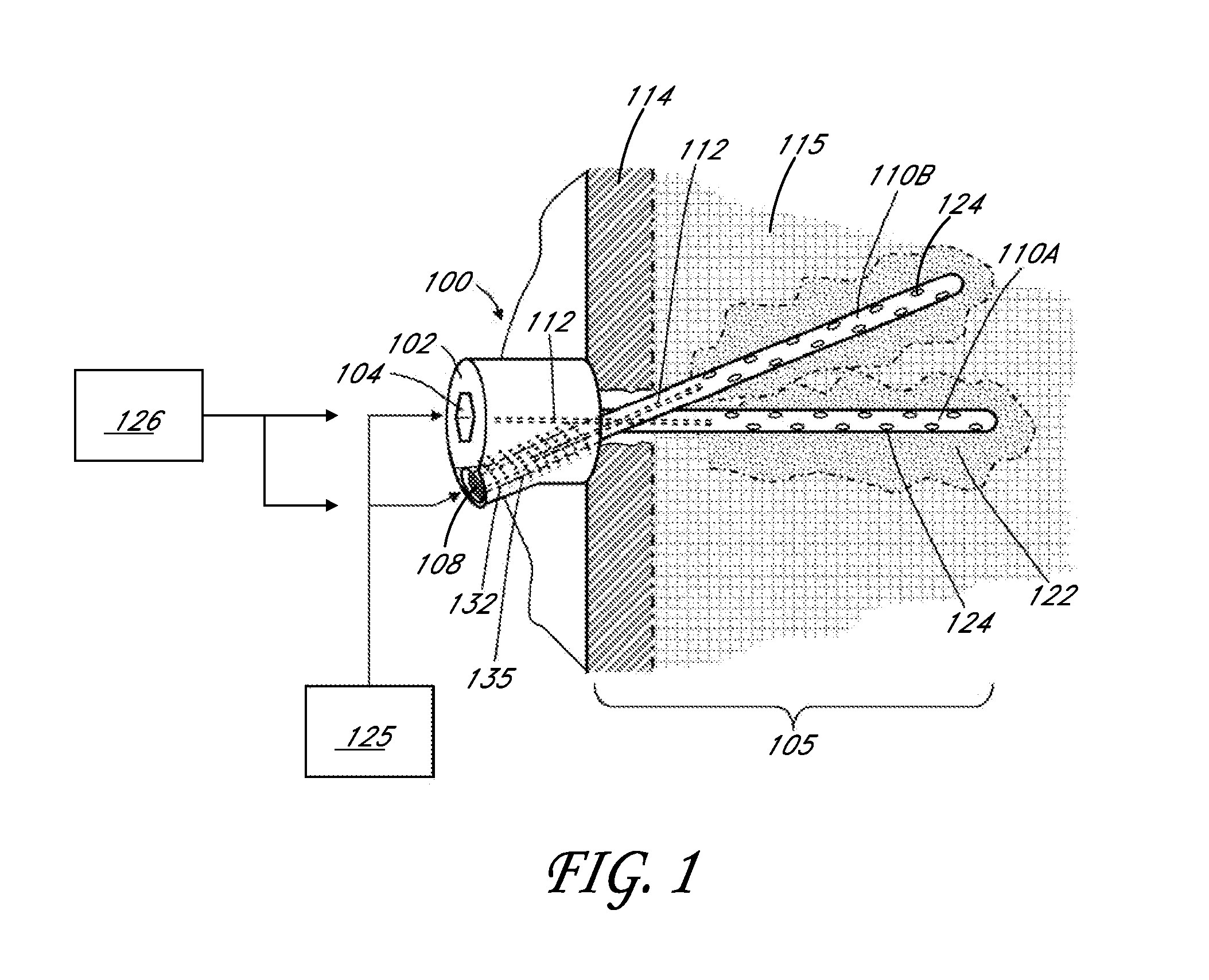 Bone anchor apparatus and method