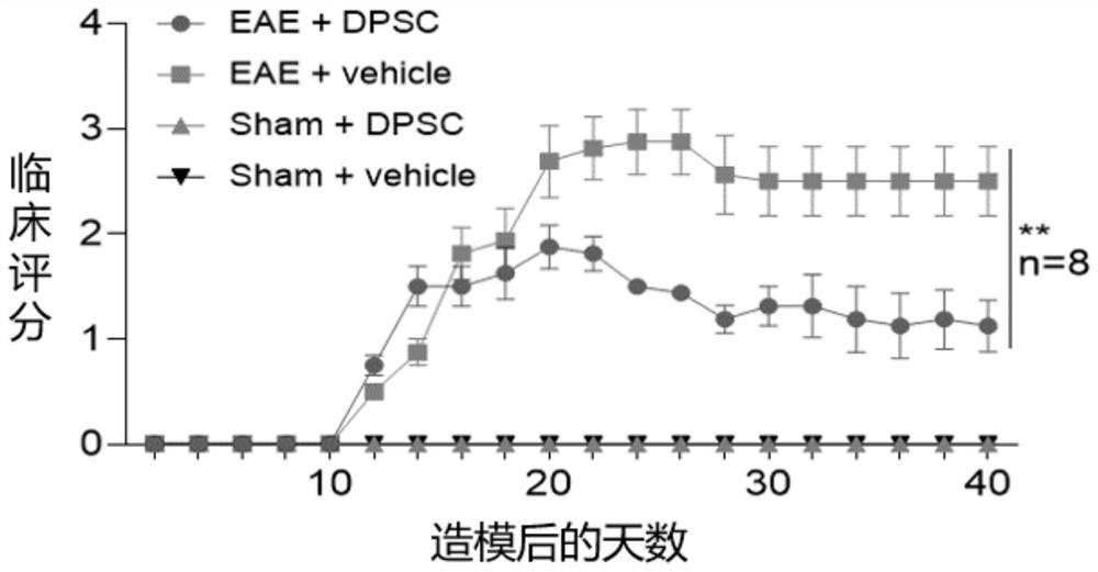 Application of dental pulp stem cells in preparation of medicine for treating multiple sclerosis