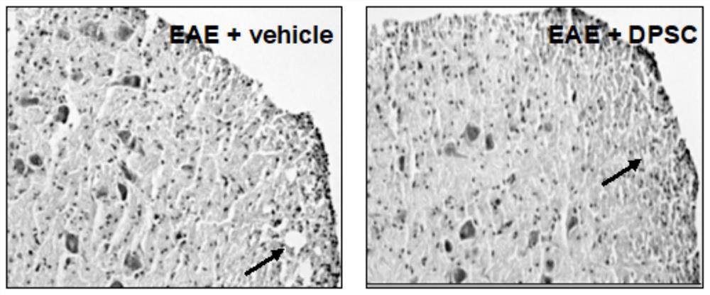 Application of dental pulp stem cells in preparation of medicine for treating multiple sclerosis