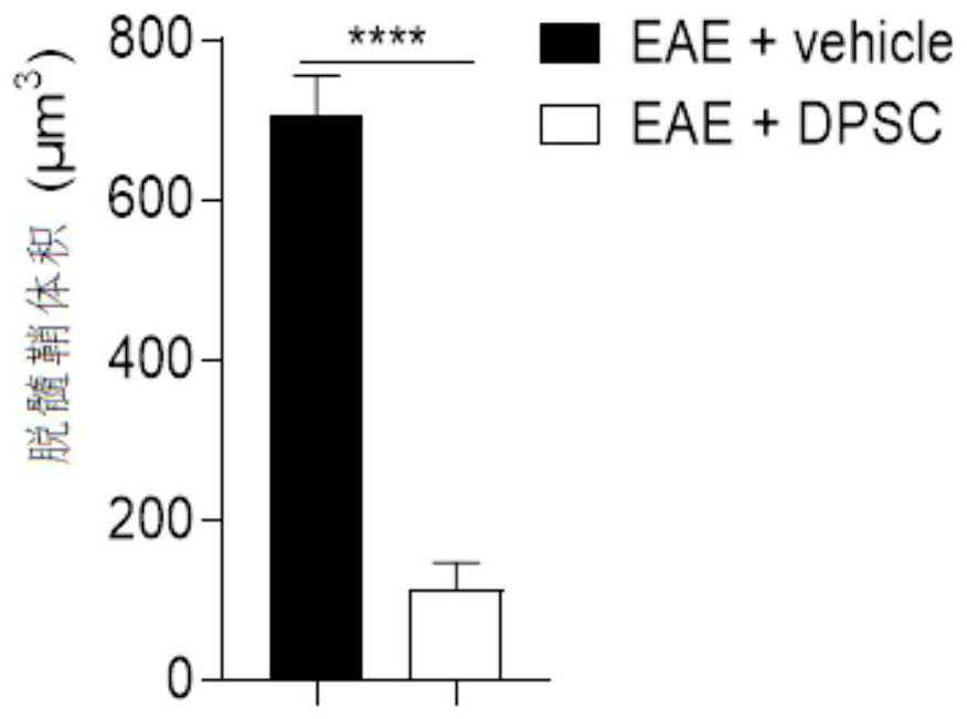 Application of dental pulp stem cells in preparation of medicine for treating multiple sclerosis