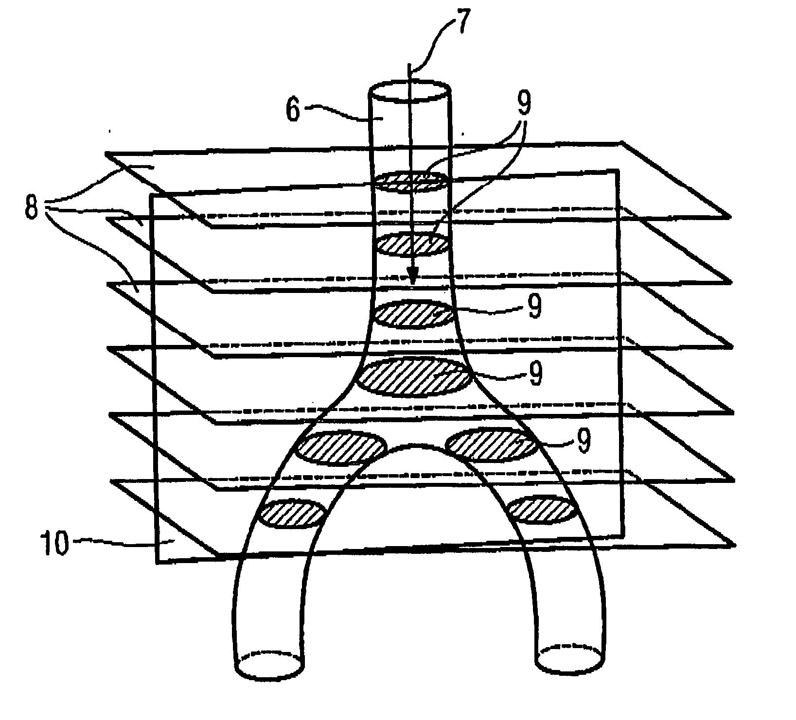 Magnetic resonance method and apparatus for determining the position and/or orientation of the image plane of slice image exposures of a vessel region in a contrast agent bolus examination