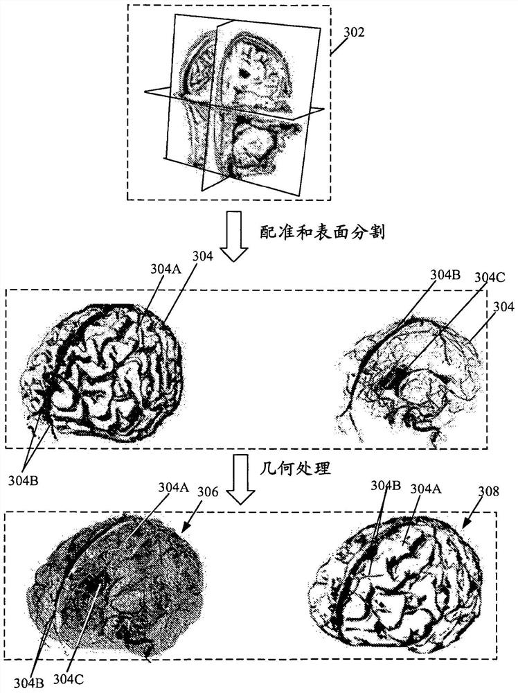 Systems and methods for providing surgical assistance in the presence of tissue deformation