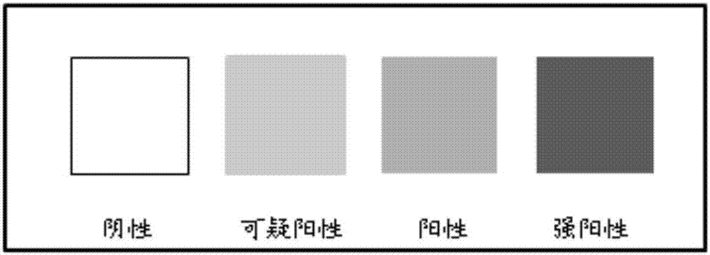 Application of protoheme and beta-glucuronidase in bronchial epithelial cell heterogeneity hyperplasia detection and kit