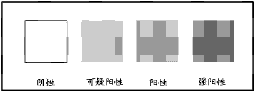 Application of protoheme and beta-glucuronidase in bronchial epithelial cell heterogeneity hyperplasia detection and kit