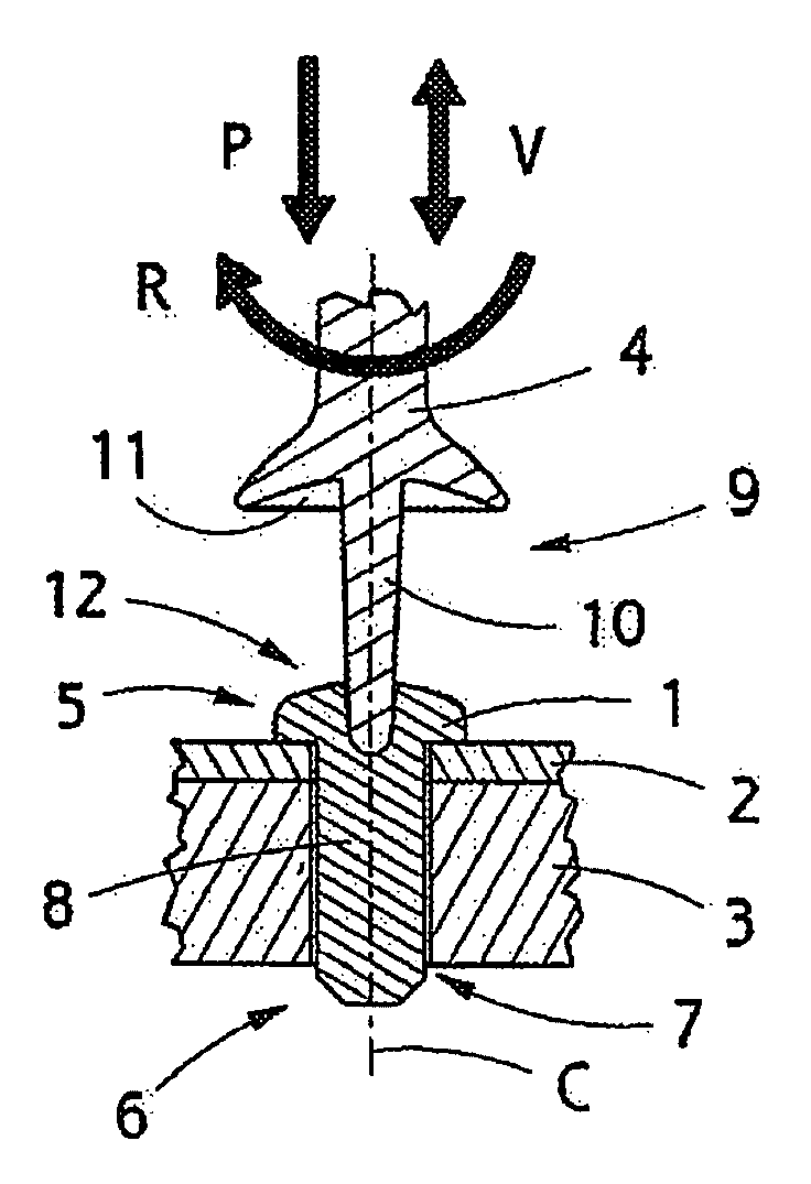 Implant, implantation tool, kit and method