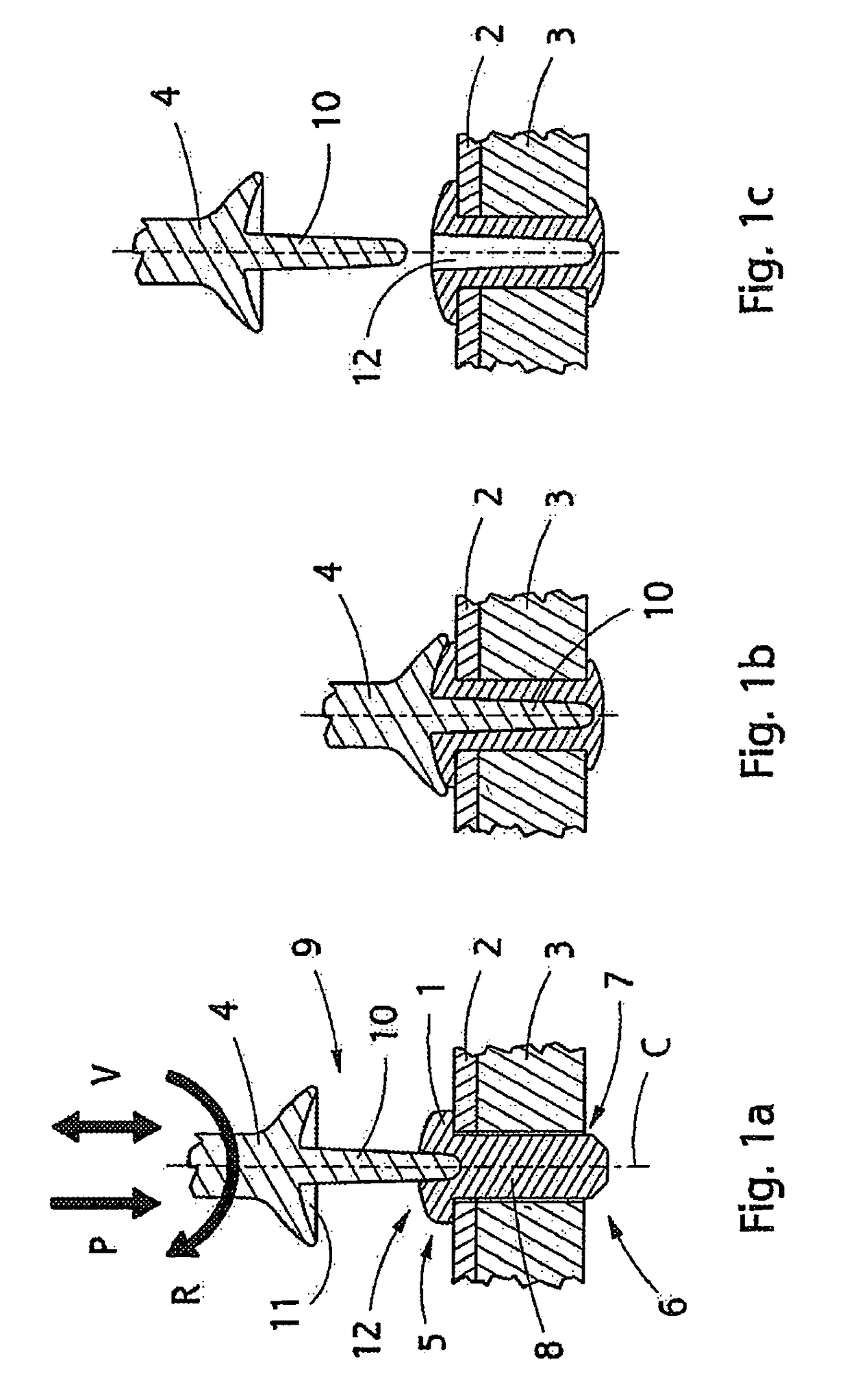 Implant, implantation tool, kit and method