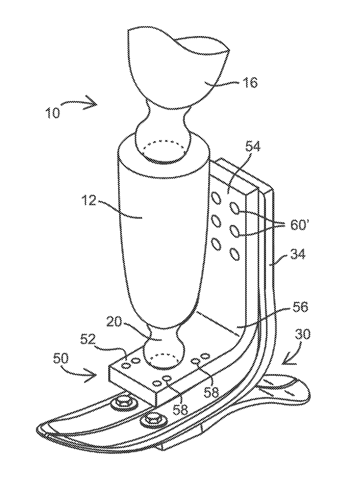 Clearance enhancer for lower limb prosthesis