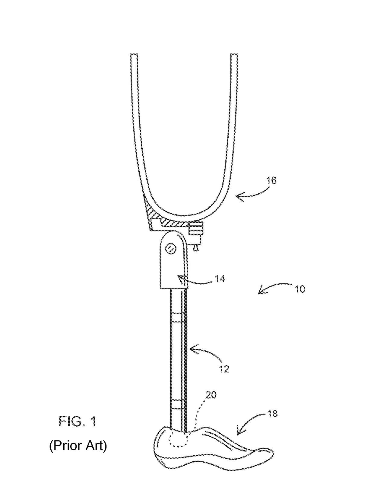 Clearance enhancer for lower limb prosthesis