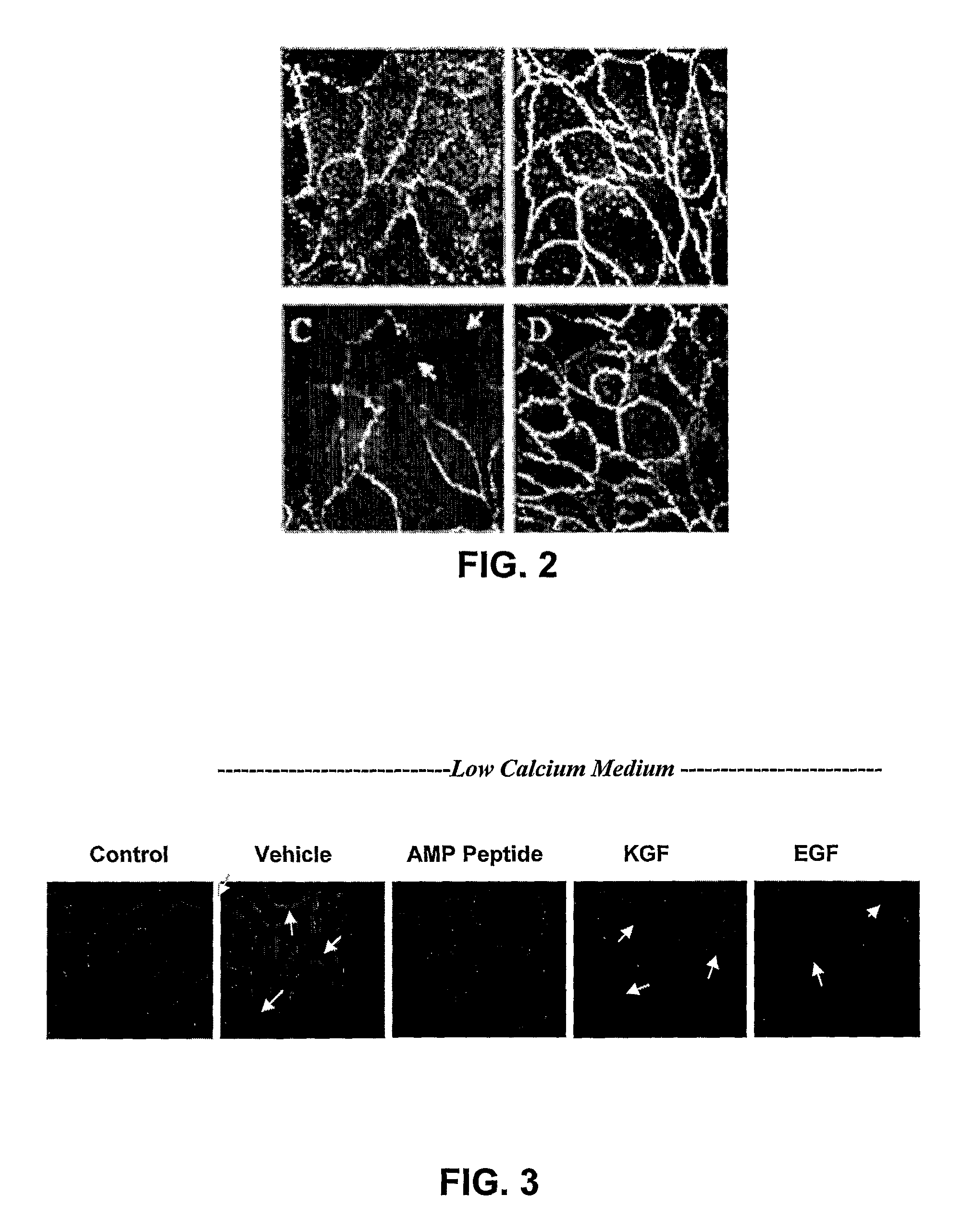 Methods and compositions to treat mucositis