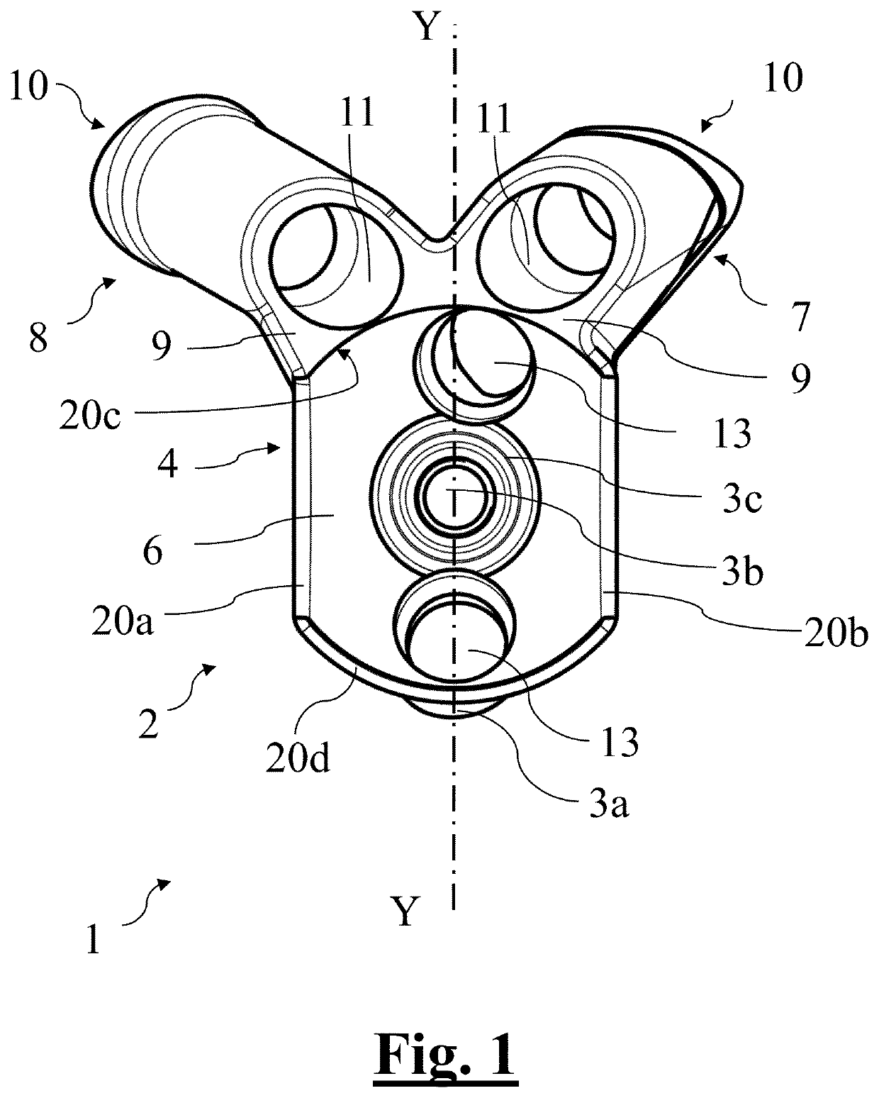 Scapular anchor for fixing a glenoid component of a shoulder joint prosthesis to a scapula with compromised anatomy and related method for manufacturing said scapular anchor