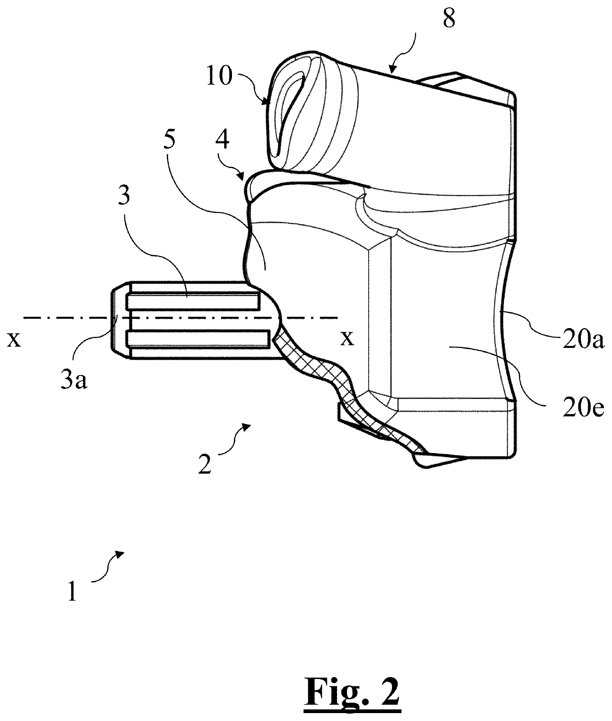 Scapular anchor for fixing a glenoid component of a shoulder joint prosthesis to a scapula with compromised anatomy and related method for manufacturing said scapular anchor