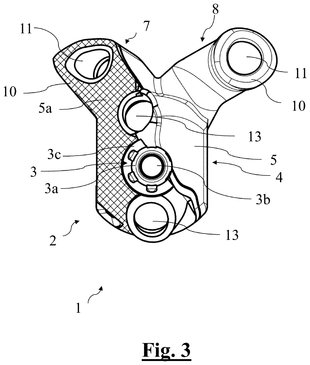 Scapular anchor for fixing a glenoid component of a shoulder joint prosthesis to a scapula with compromised anatomy and related method for manufacturing said scapular anchor