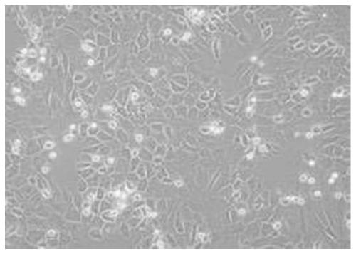 A fast and efficient method for isolating chondrocytes