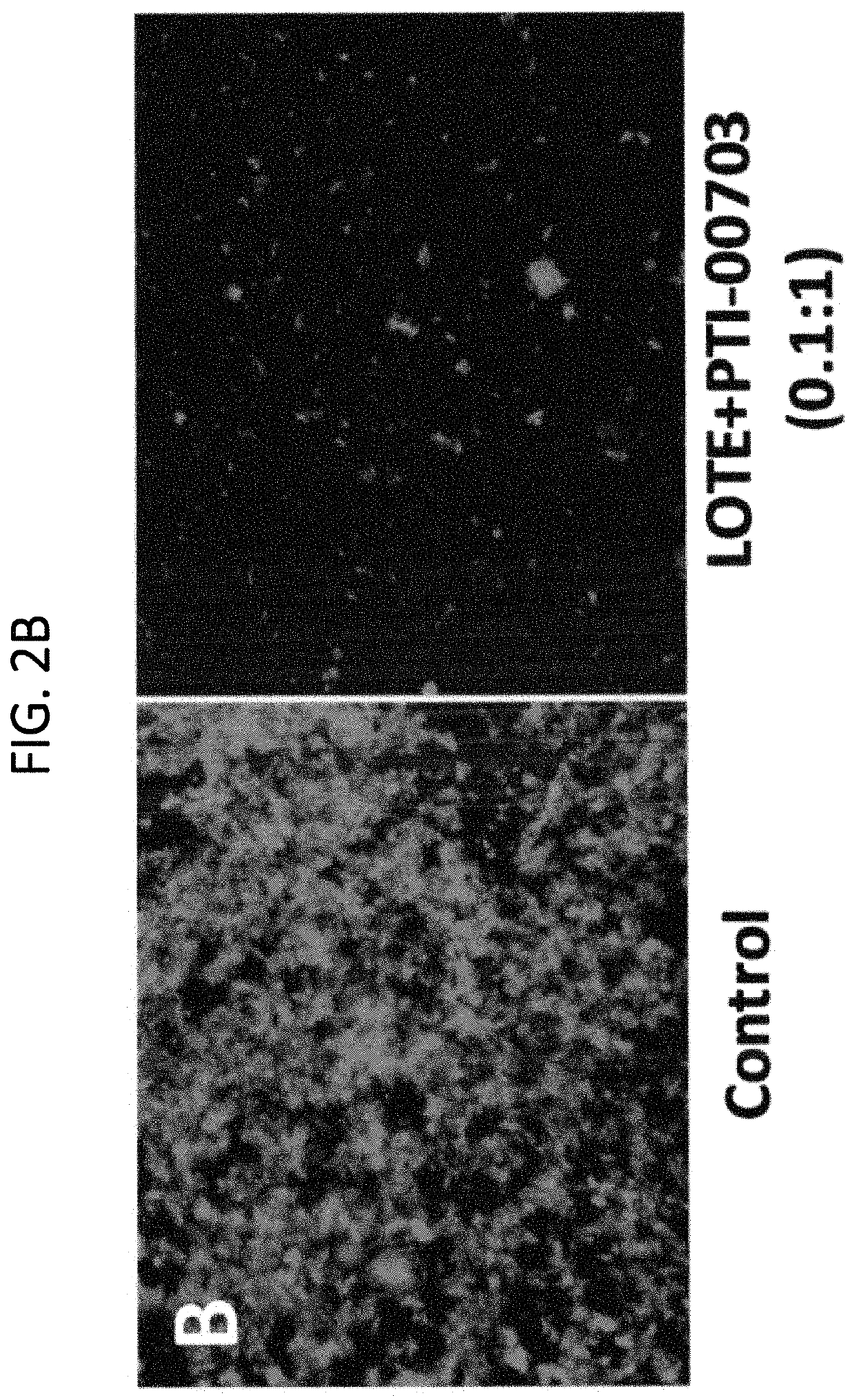 Compositions and methods for the treatment of “plaques and tangles” in humans and animals