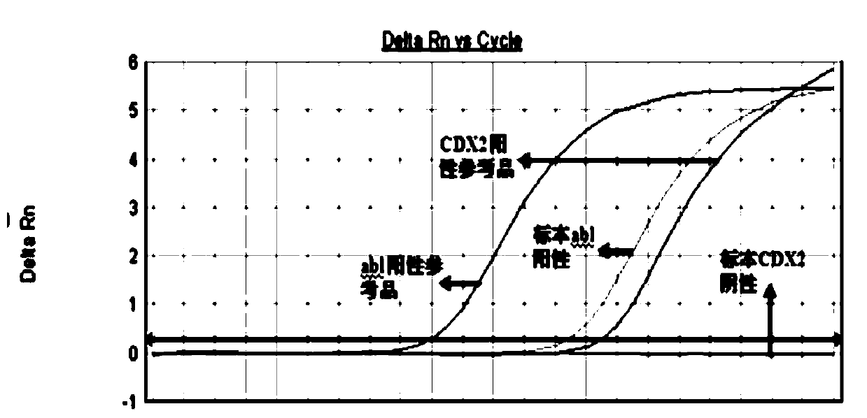 Primers and method for detecting expression level of leukemia cdx2 gene