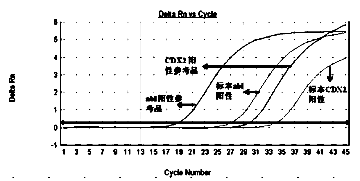 Primers and method for detecting expression level of leukemia cdx2 gene