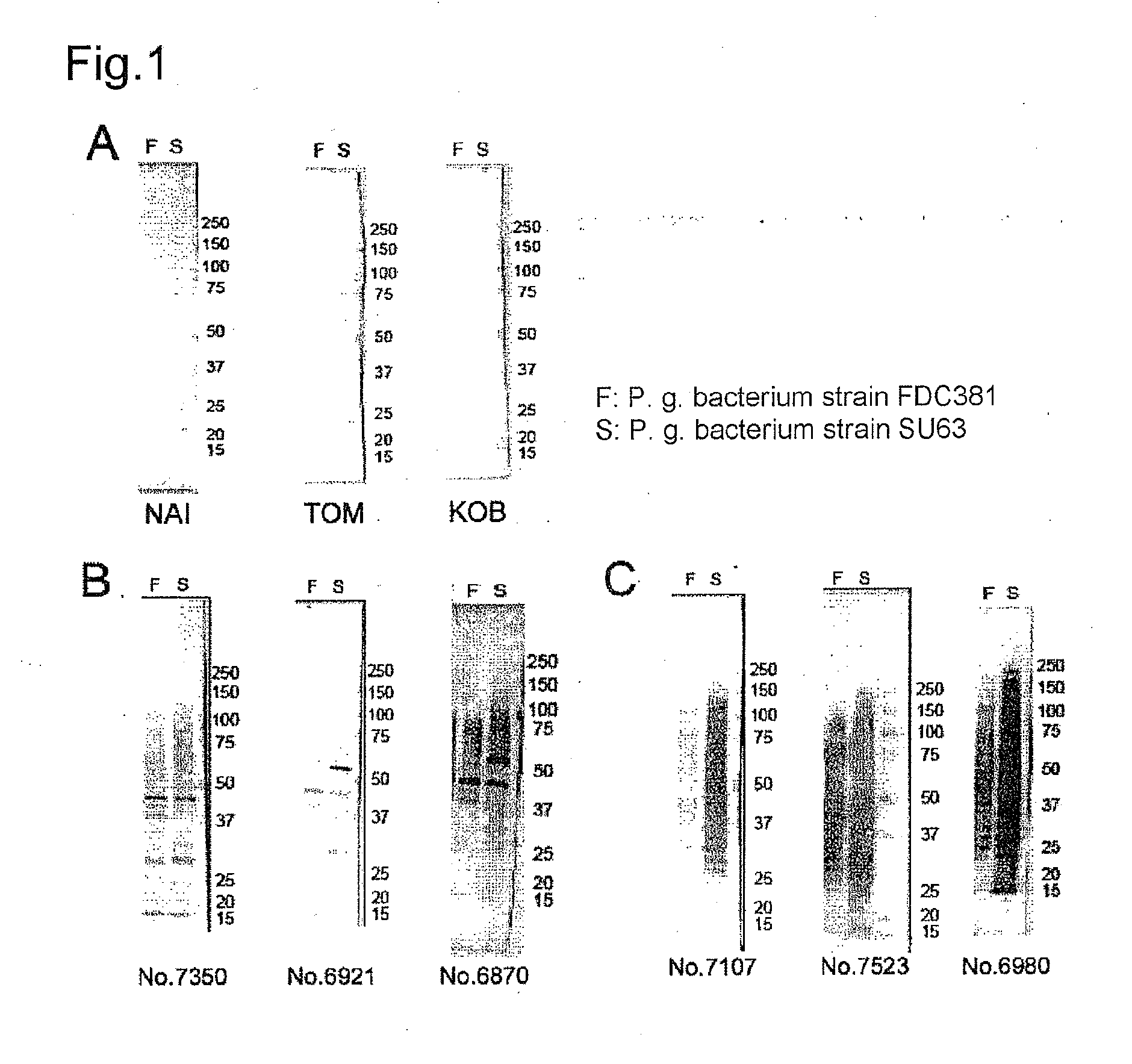 Test kit for plasma or serum antibody titer against periodontal disease-causing bacteria