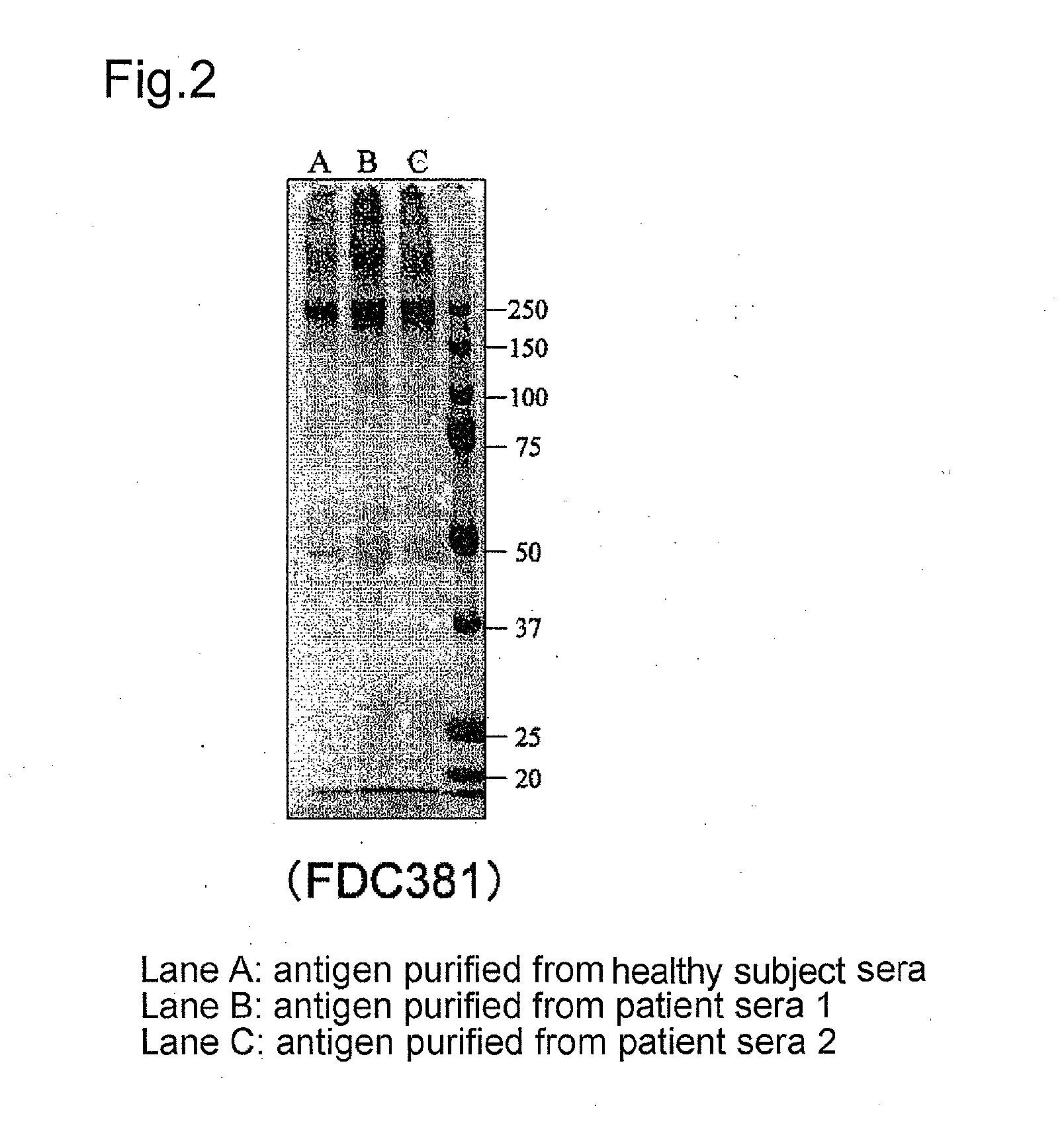 Test kit for plasma or serum antibody titer against periodontal disease-causing bacteria