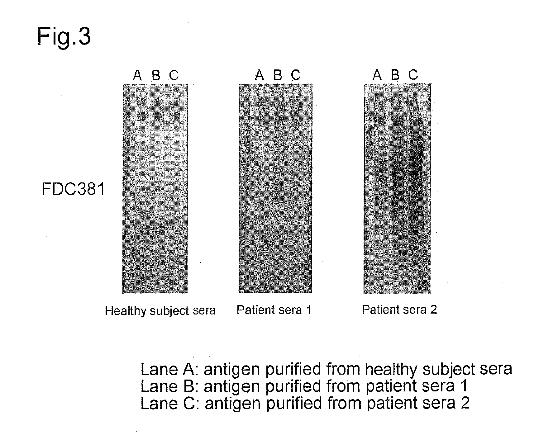 Test kit for plasma or serum antibody titer against periodontal disease-causing bacteria