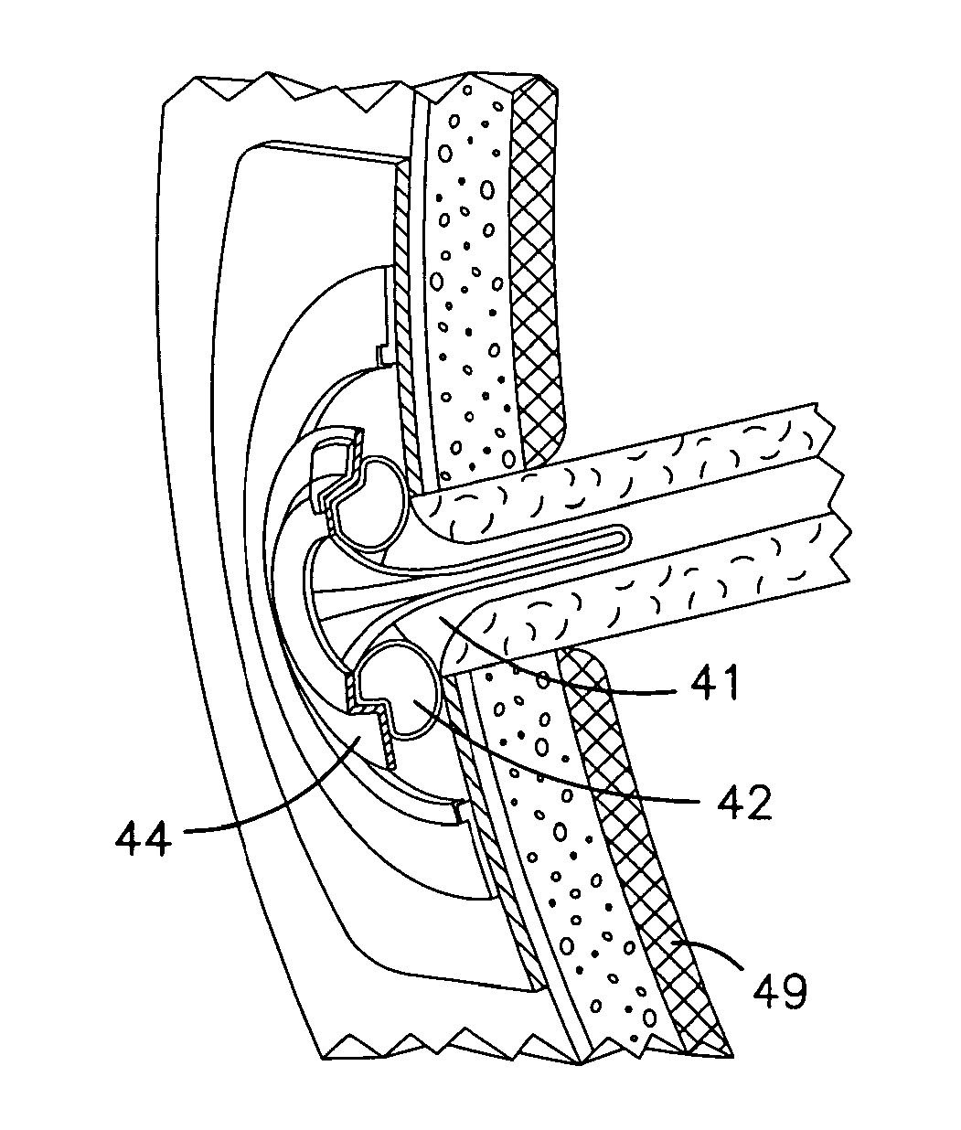 Ostomy appliances for effluent control