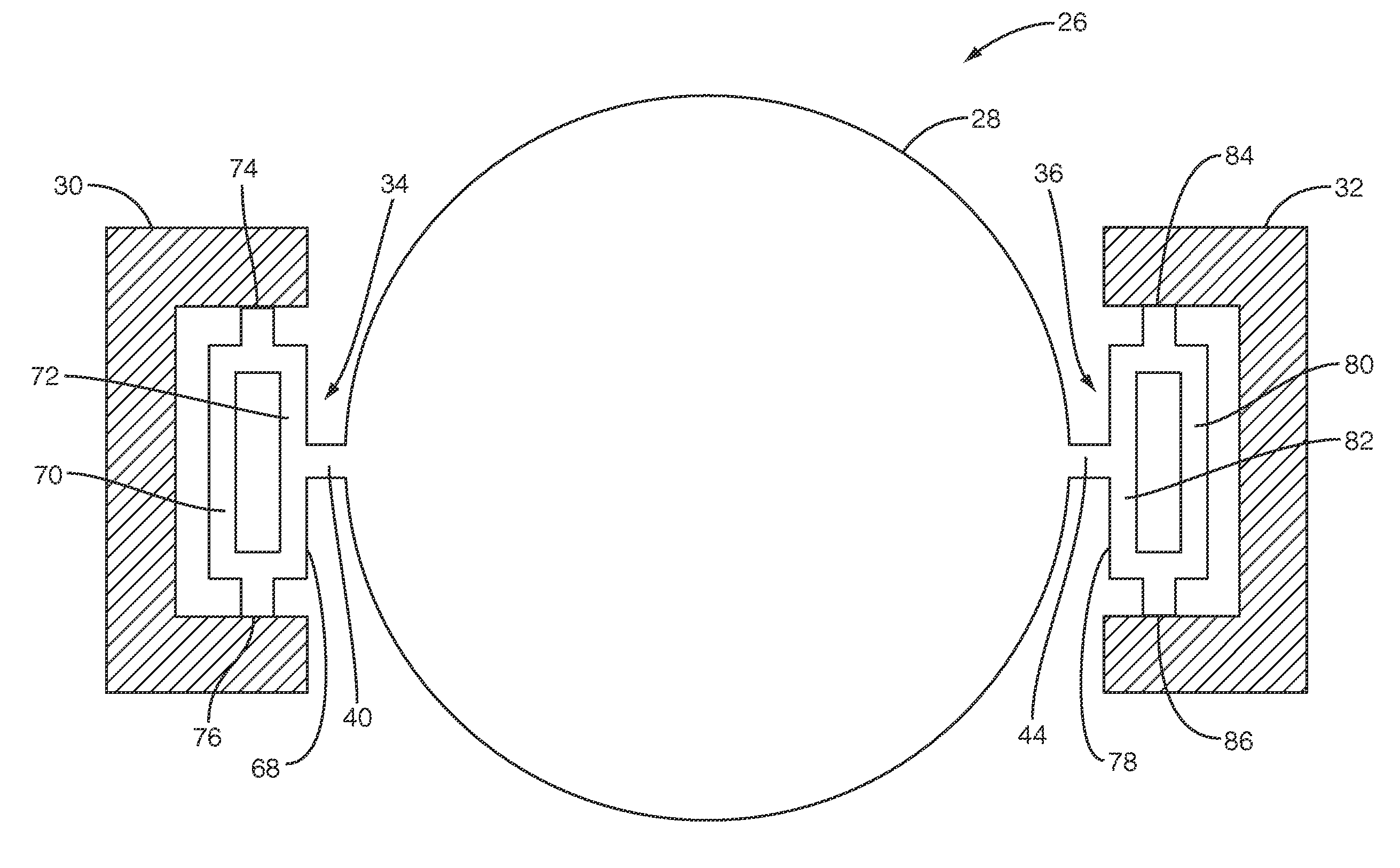 Anchor/support design for MEMS resonators