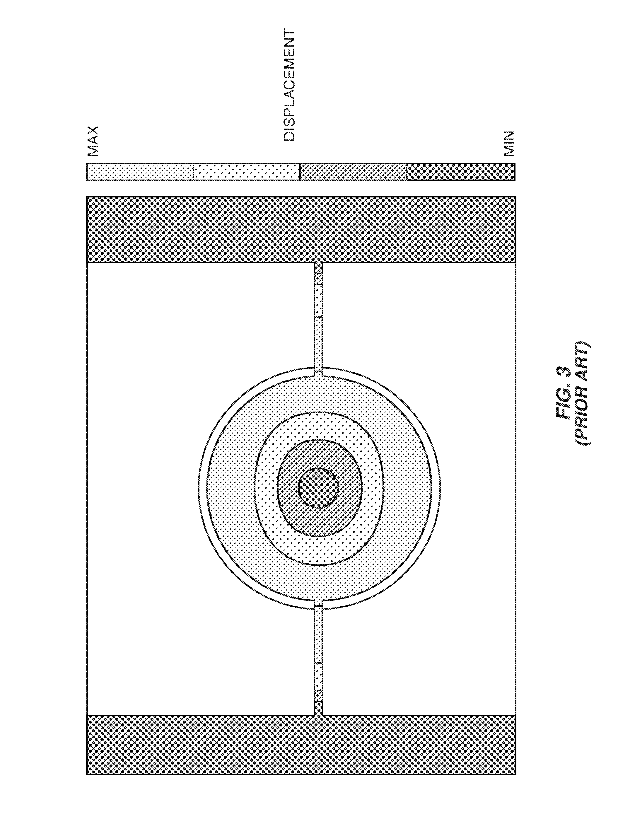 Anchor/support design for MEMS resonators