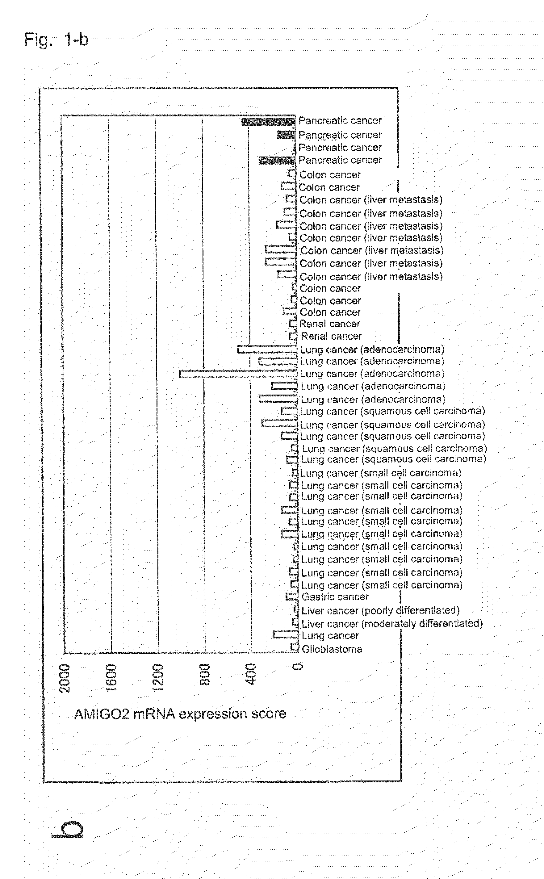 Diagnostic agent and therapeutic agent for pancreatic cancer