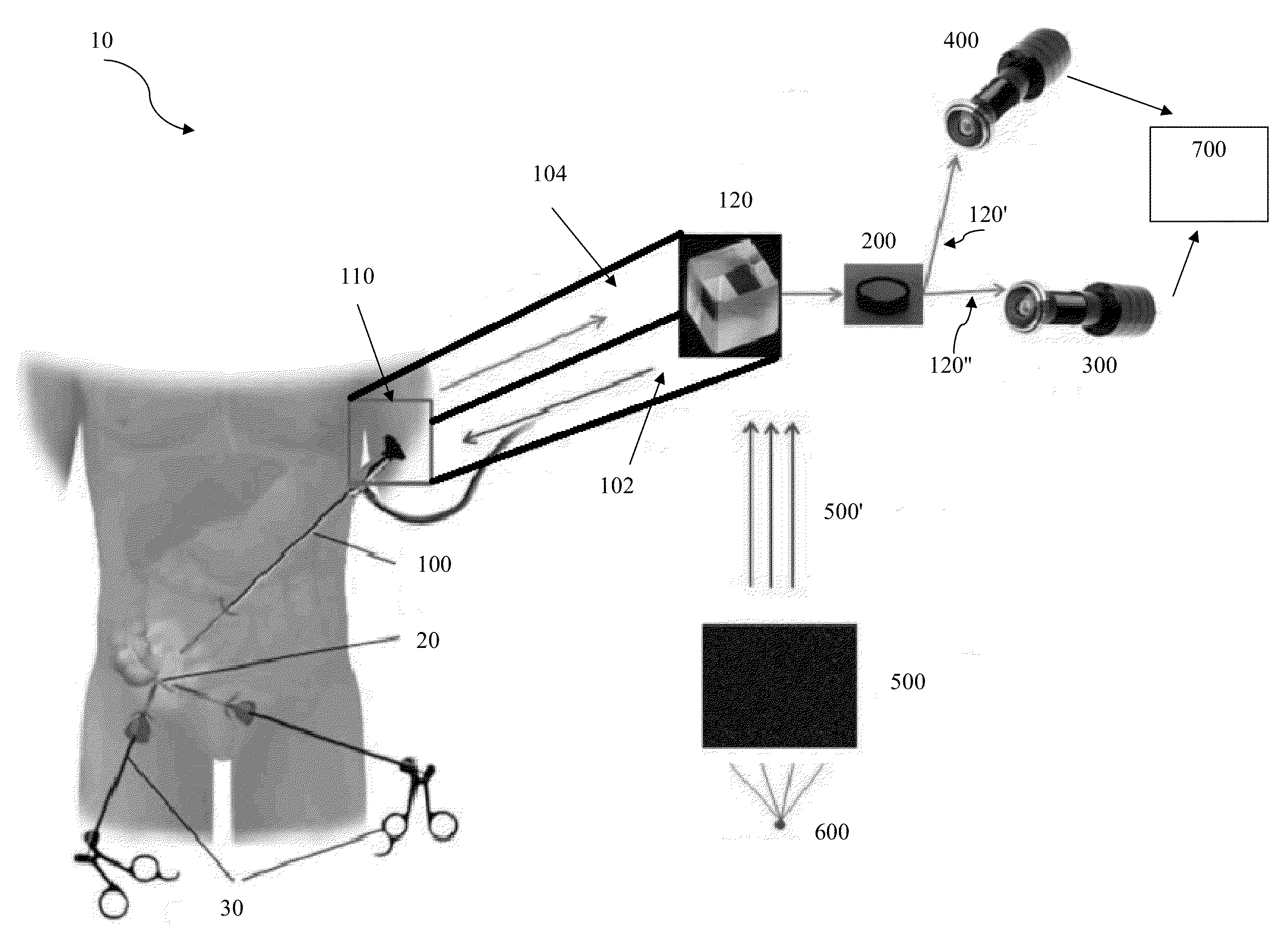 Surgical structured light system