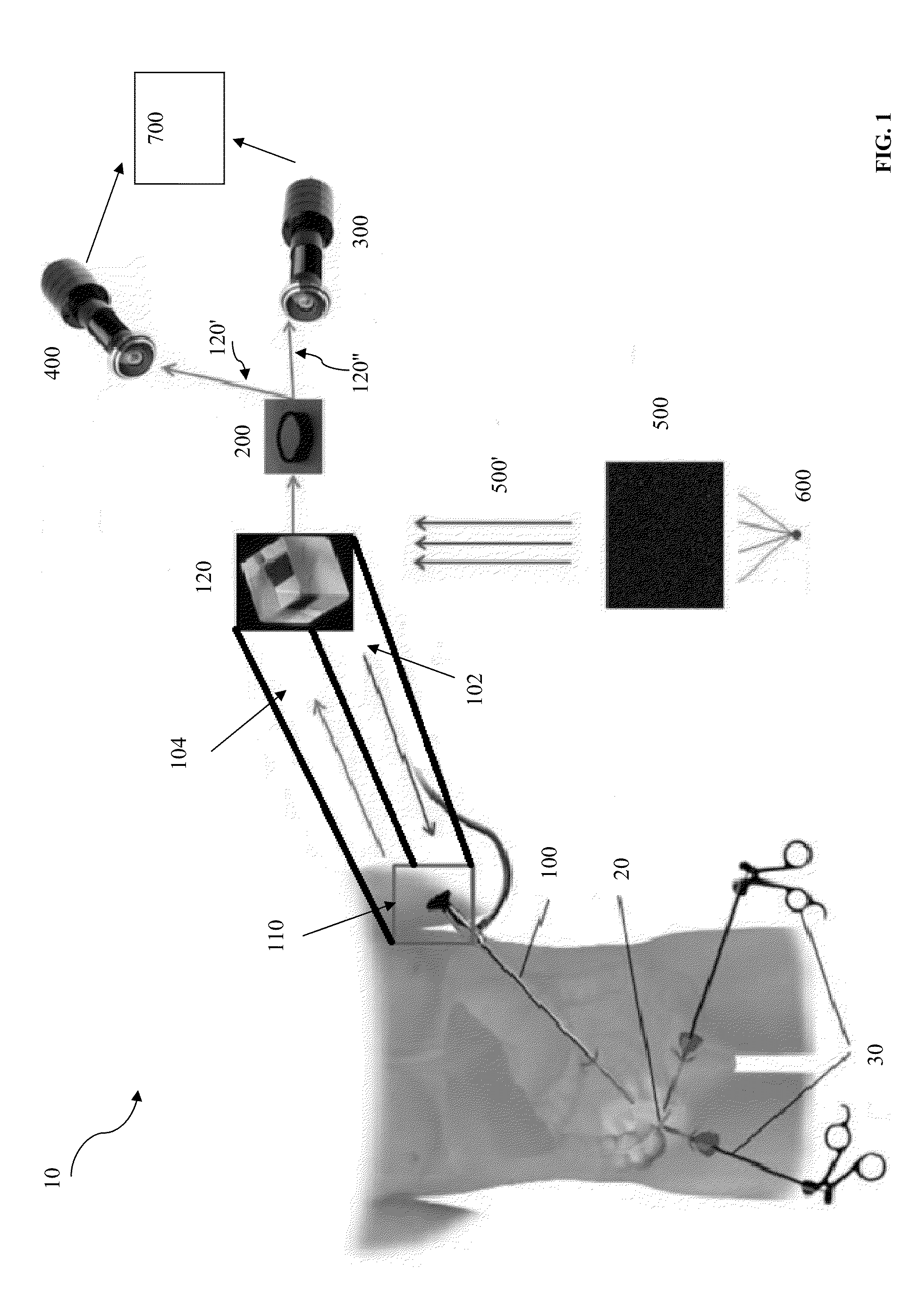 Surgical structured light system