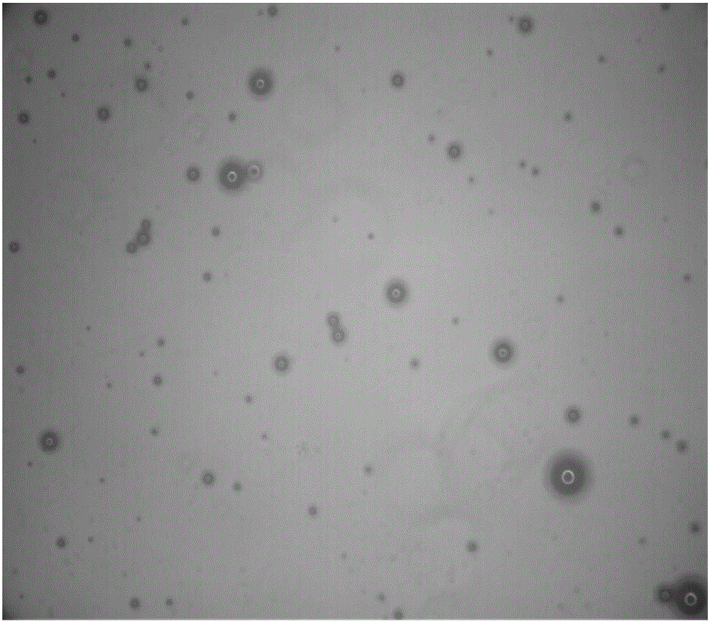 Nanometer chitosan ultrasonic microbubble targeting prostate cancer cells and preparation and application thereof