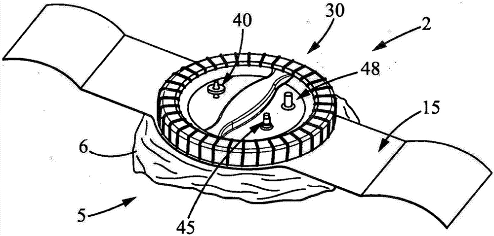 Microorganism sampling method, microorganism sampling device and sampling kit comprising such a sampling device