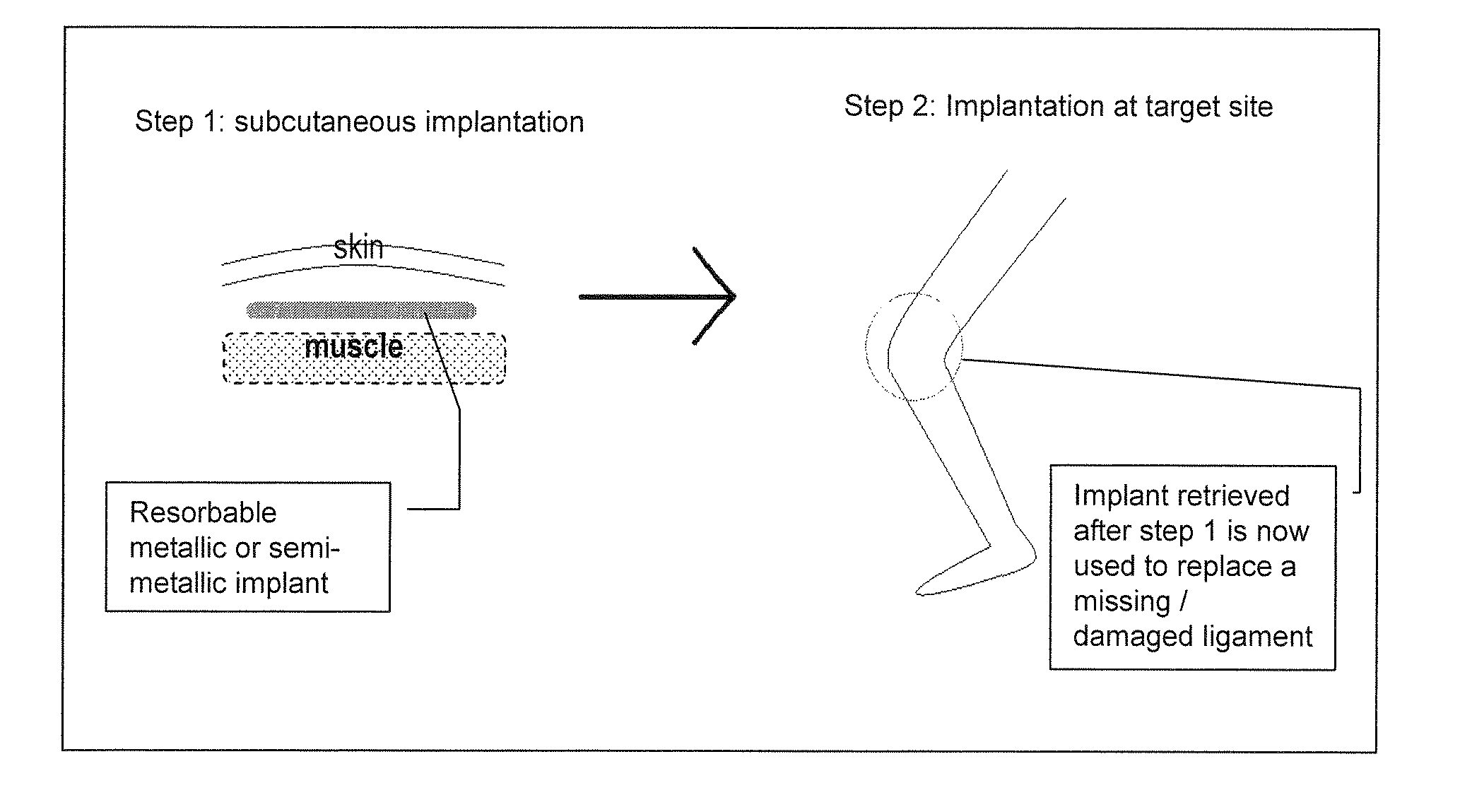 Implant for tissue engineering