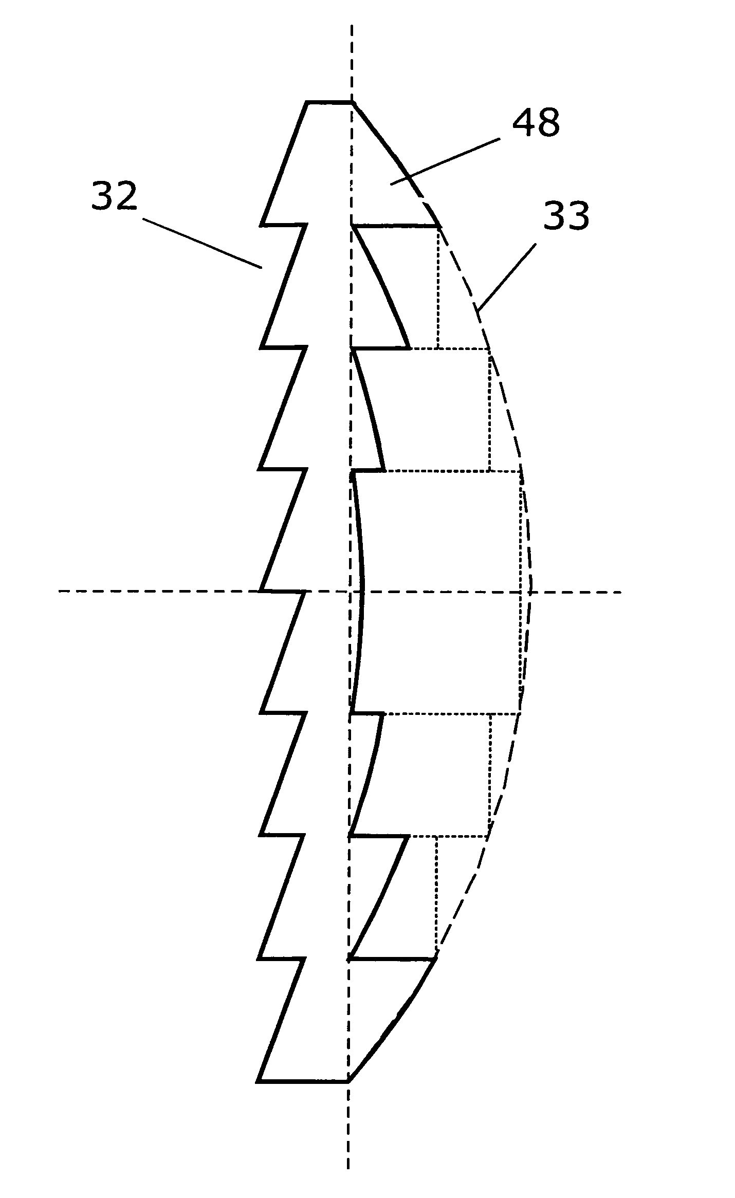 Intraocular lens device for the improvement of vision in case of retinal diseases