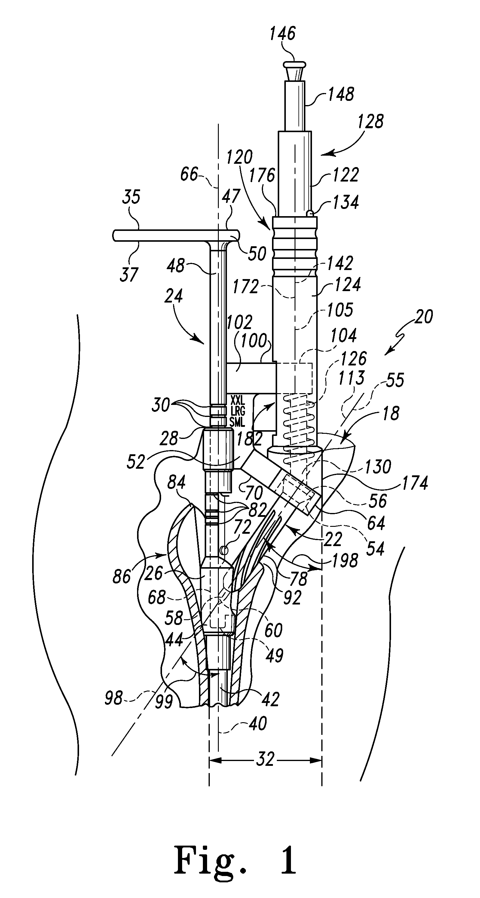 Minimally Invasive Bone Miller Apparatus