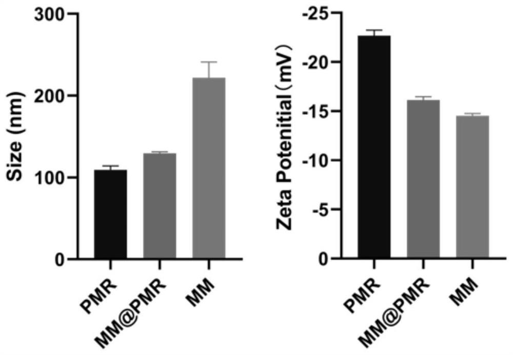 Nano-drug for inhibiting injured vascular intimal hyperplasia and application of nano-drug