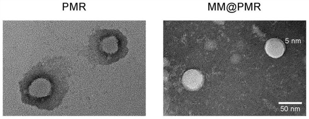 Nano-drug for inhibiting injured vascular intimal hyperplasia and application of nano-drug