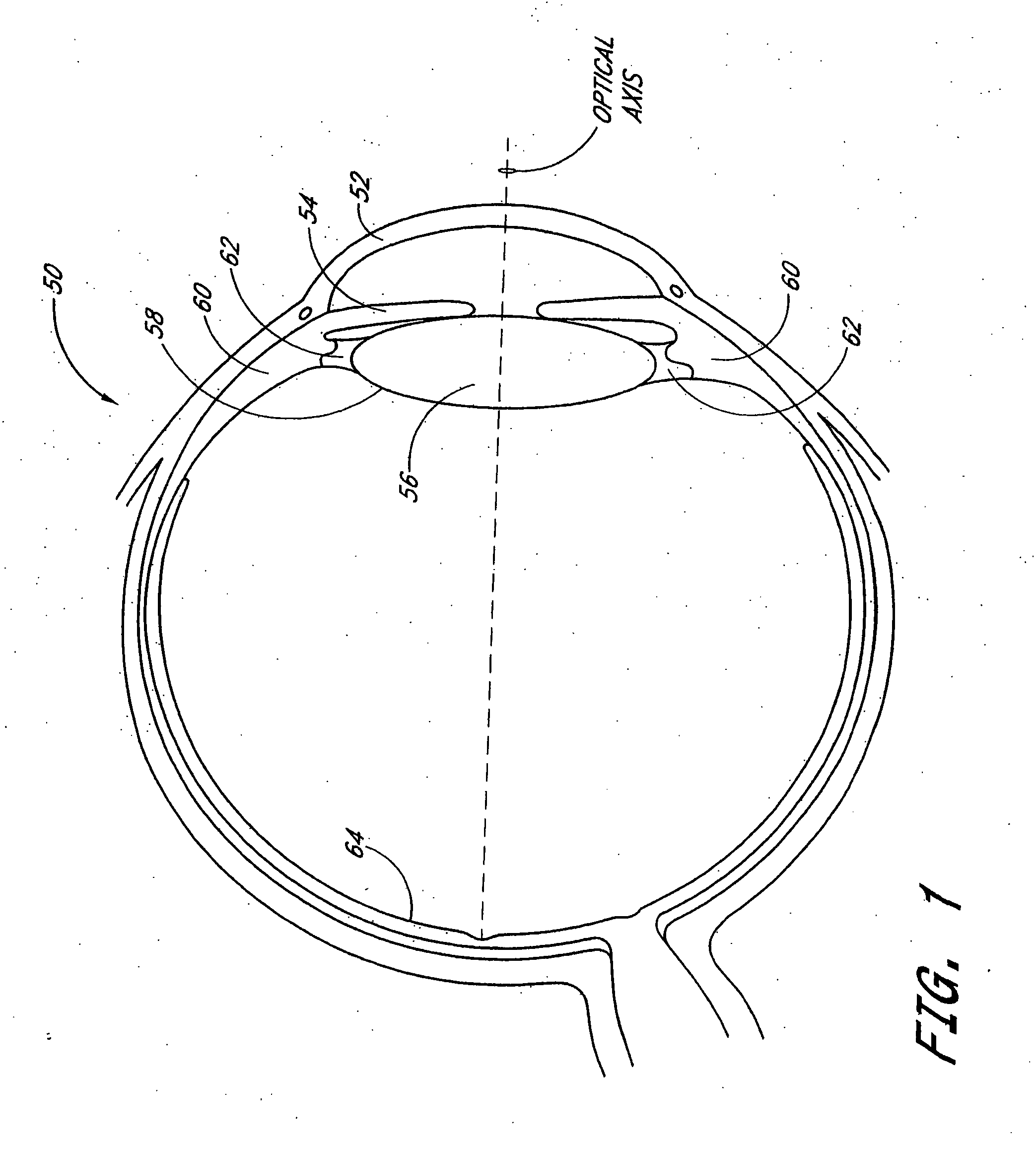 Accommodating intraocular lens system with aberration-enhanced performance