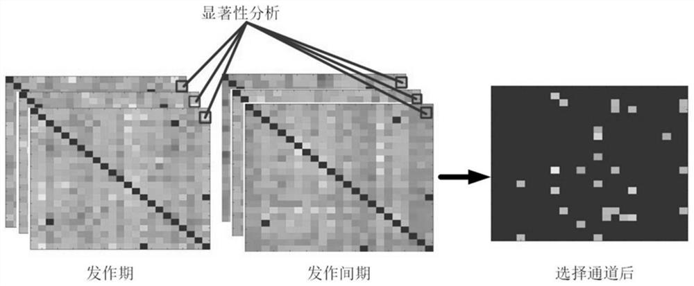 Symbolized permutation transfer entropy-based epileptic electroencephalogram bidirectional coupling analysis method