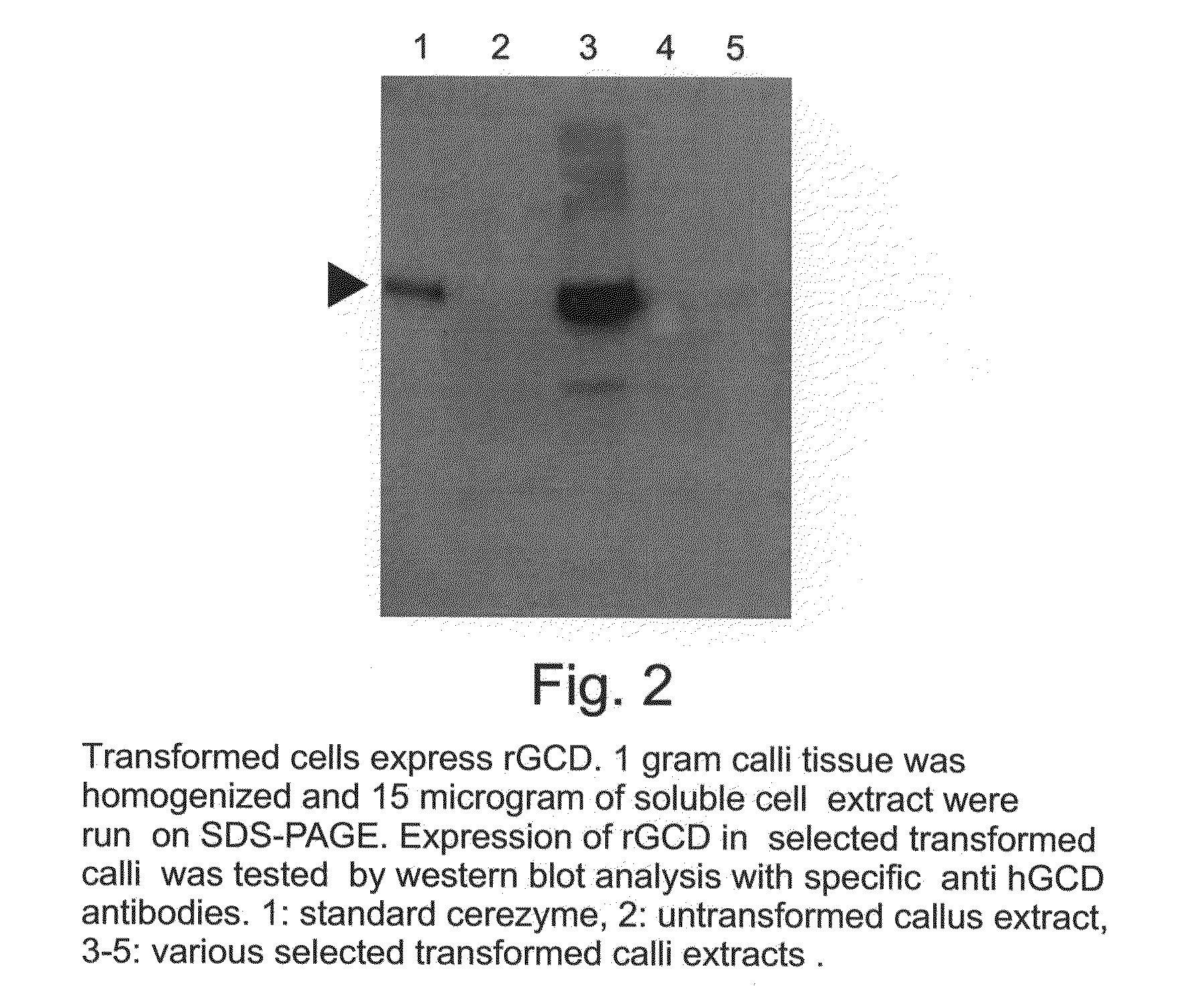 Production of high mannose proteins in plant culture