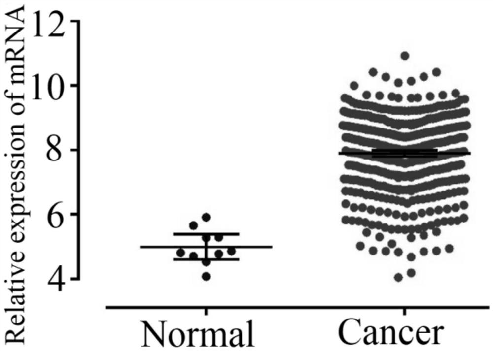 A kind of glioma prognostic marker cpvl and its application