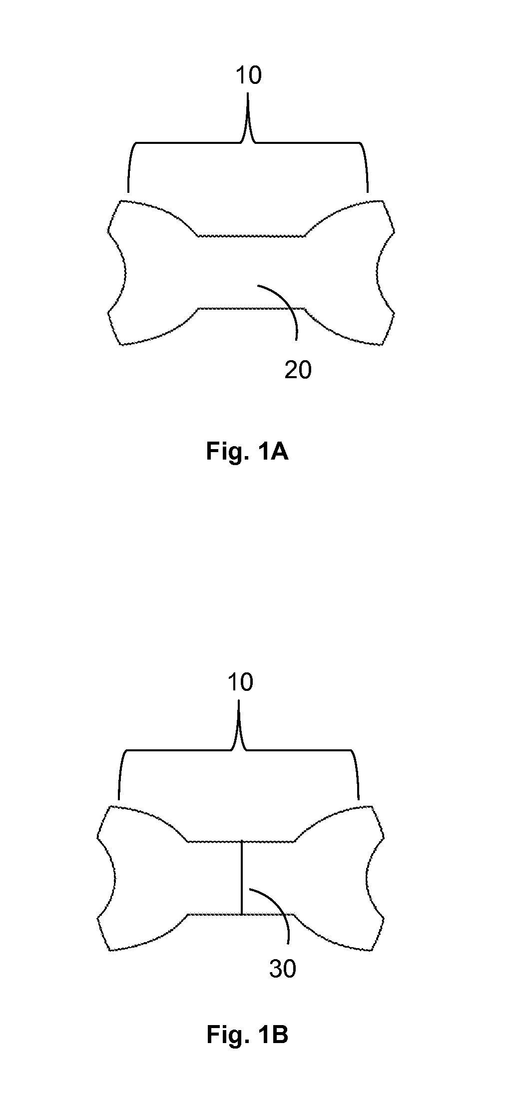 External nasal dilator and method of use