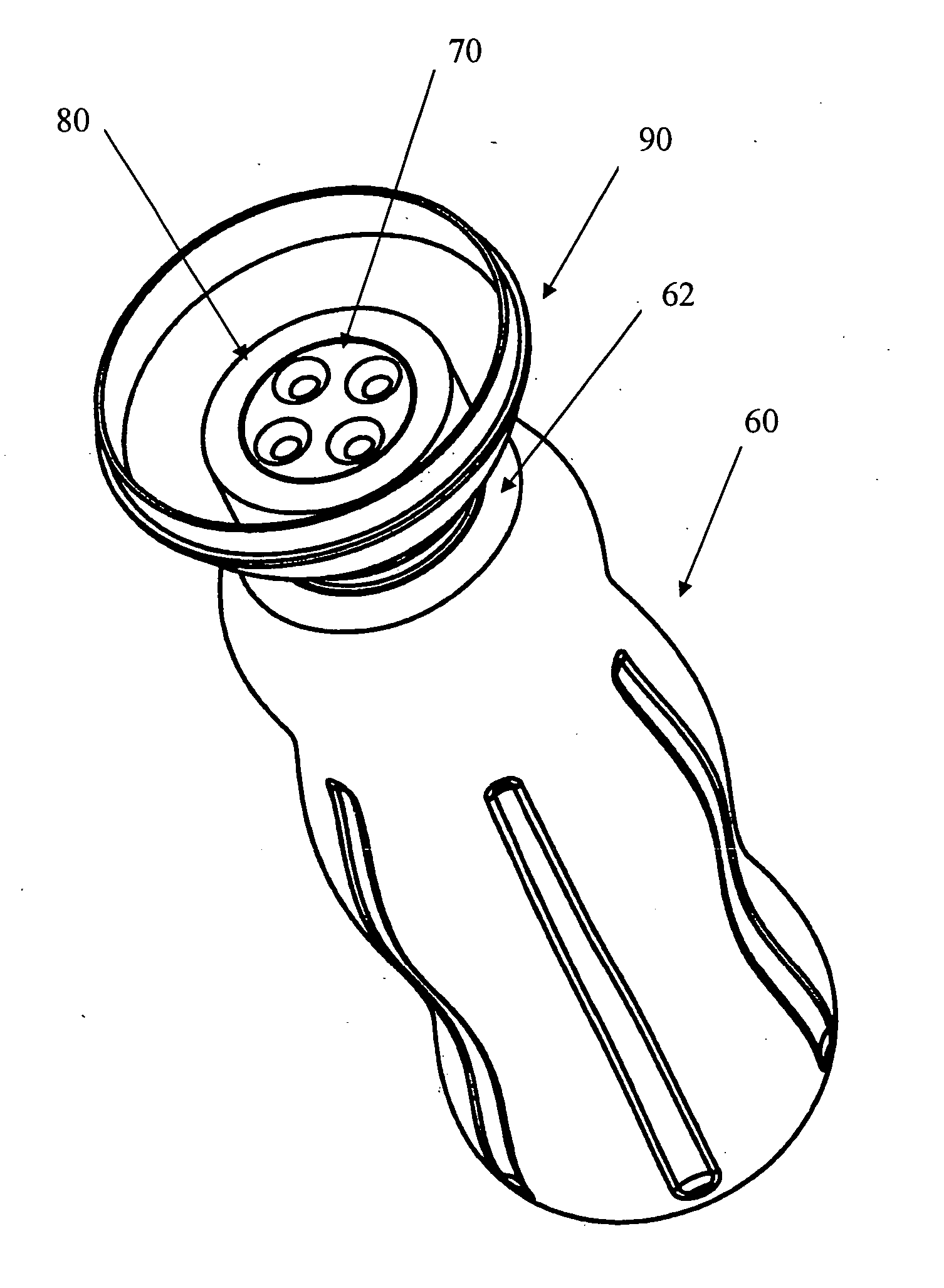 Novel wound irrigation device and method