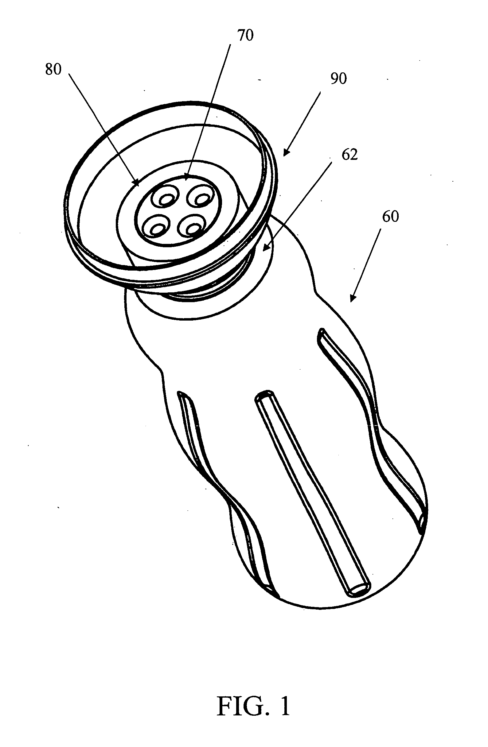 Novel wound irrigation device and method