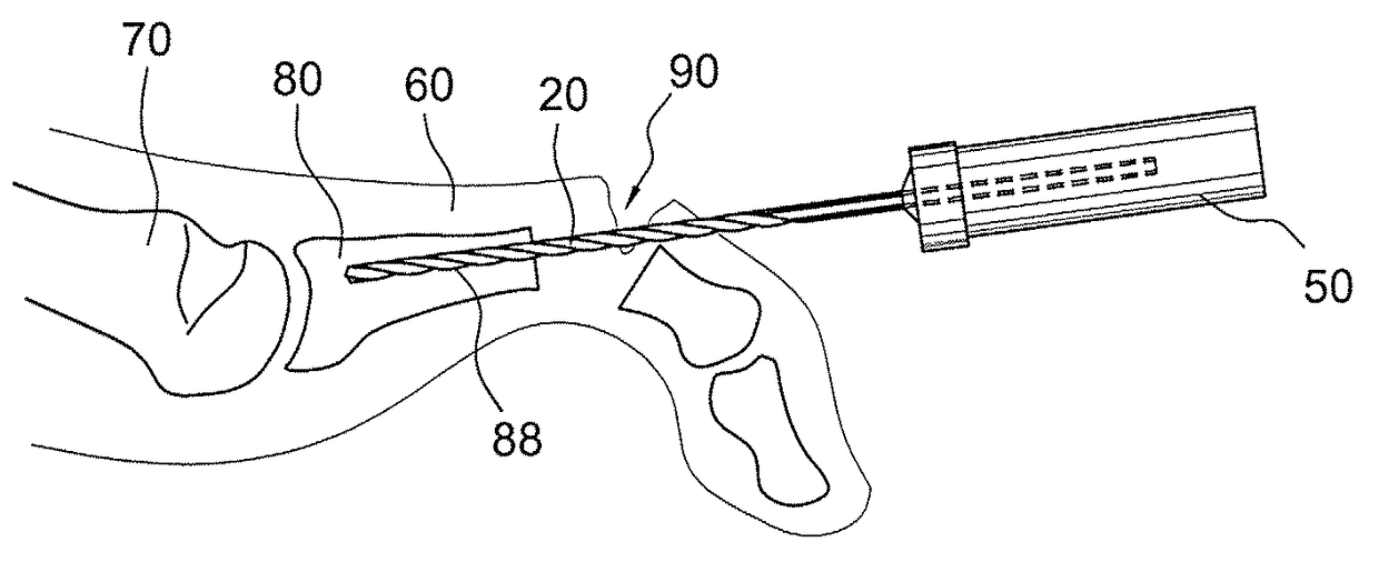 Drill/driver hybrid instrument for interphalangeal fusion