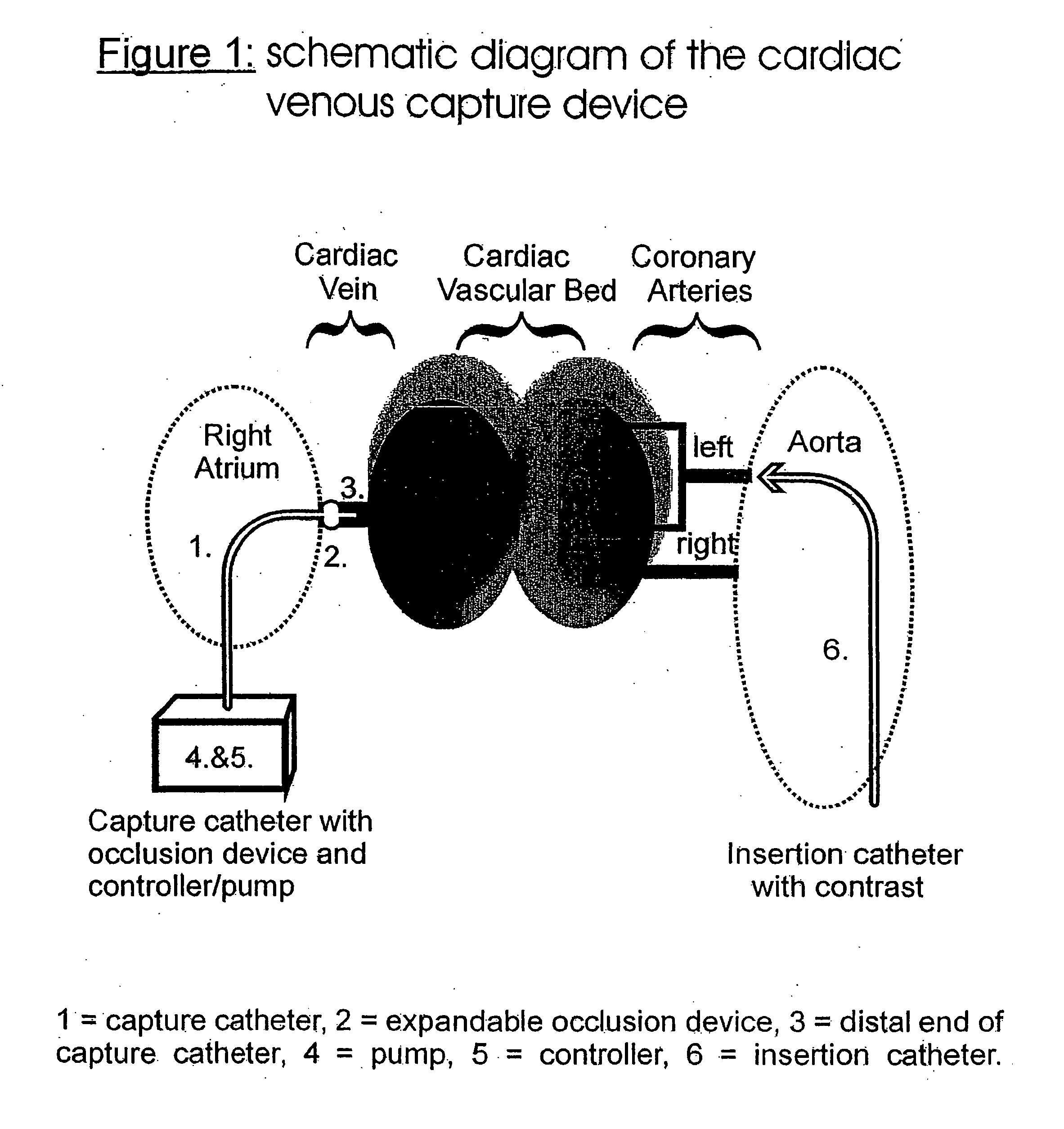 Method and device to recover diagnostic and therapeutic agents